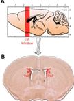 Primary Culture of SVZ-derived Progenitors Grown as Neurospheres