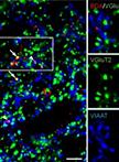 Retrograde and Anterograde Tracing of Neural Projections