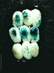 Maize Embryo Transient Transformation by Particle Bombardment