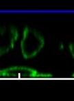Three-dimensional Invasion Assay