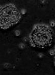 Chemosensitivity Assay