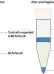 Isolation of Mouse Tumor-Infiltrating Leukocytes by Percoll Gradient Centrifugation