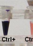 Pyruvate:ferredoxin Oxidoreductase (PFR1) Activity Assays Using Methyl Viologen as Artificial Electron Acceptor