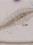 RNA Isolation From Meloidogyne Spp. Galls