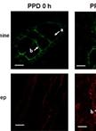 Fluorescence Measurement of Postharvest Physiological Deterioration (PPD) in Cassava Storage Roots
