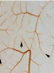In vivo Chick Chorioallantoic Membrane (CAM) Angiogenesis Assays