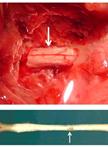 Rat Model of Chronic Midthoracic Lateral Hemisection