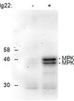 MAPK Phosphorylation Assay with Leaf Disks of Arabidopsis