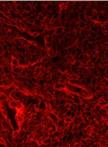 Hypertrophy Analysis and Quantification in Embryonic Cardiomyocites