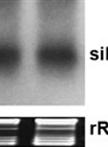 A High Resolution Short Interfering RNA (siRNA) Detection Method from Virus-infected Plants