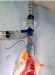 Gastric Aspiration Models