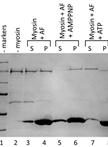 Binding Assay of Cytosolic Proteins to the Cytoskeleton