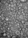 Preparation of Outer Membrane Vesicle from Escherichia coli