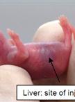 Serial Transfer of Human Hematopoietic and Hepatic Stem/progenitor Cells