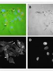 Invadopodia Detection and Gelatin Degradation Assay