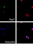 Preparation of Adult Mouse Muscle Stem Cells