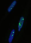 附着培养哺乳动物细胞的ImmunoFISH试验