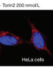 Autophagy Assays (LC3B immunofluorescence, LC3B western blot, acridine orange assay)