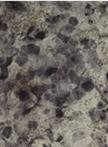 Intestinal Differentiation of Human ESCs