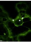 Subcellular Localization Experiments and FRET-FLIM Measurements in Plants