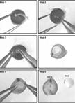Retinal Explant Culture