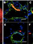 In vivo Extravasation Assay