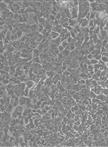 Isolation of Mammary Epithelial Cells and Fibroblasts From Mouse Tumor