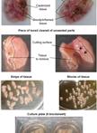 An ex vivo Model of HIV-1 Infection in Human Lymphoid Tissue and Cervico-vaginal Tissue