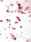 Binding to Secreted Bone Matrix in vitro
