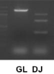 基于DNA的PCR法分析免疫球蛋白重链（Igh）的重排