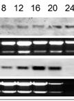 RNA Isolation and Northern Blot Analysis