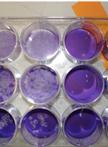 Virus Infection and Titration of SARS-CoV in Mouse Lung