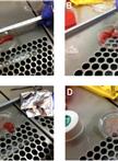 Isolation of Cells from Human Intestinal Tissue