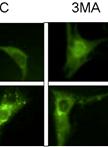 Fluorescence Microscopy Analysis of Drug Effect on Autophagosome Formation