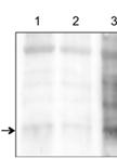 Purification and Fluorescent Labeling of Exosomes