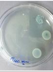体外微量滴定测定法测定生物膜的最小杀菌浓度(MBC-B)