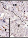 Immunostaining Protocol: P-Smad2 (Xenograft and Mice)