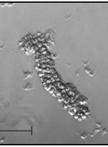 Isolation and 3-dimensional Culture of Primary Murine Intestinal Epithelial Cells