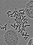 Karyotype Analysis