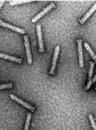 Purification and TEM of Afp and Its Variants