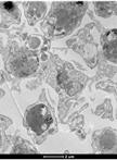 Immuno-EM Analysis of PF13_0191-GFP Expressing Parasites