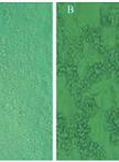 基于SYBR Green荧光染料的实时逆转录聚合酶链式反应（RT-PCR）试验检测新生 H7N9 病毒