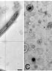 Ciliary and Flagellar Membrane Vesicle (Ectosome) Purification