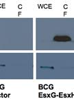 Analysis of Mycobacterial Protein Secretion 