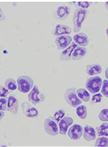 Bone Marrow Derived Eosinophil Cultures