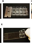 Phagolysosomal Trafficking Assay 