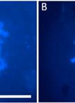 Rice Meiotic Chromosome Spread Preparation of Pollen Mother Cells