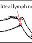 β-淀粉样蛋白（Aβ）特异性T淋巴细胞系的建立和过继转移
