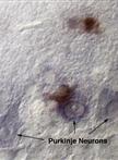 Combined <em>in situ</em> Hybridization/Immunohistochemistry (ISH/IH) on Free-floating Vibratome Tissue Sections