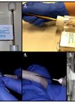 Hypoxia Studies with Pimonidazole in vivo
